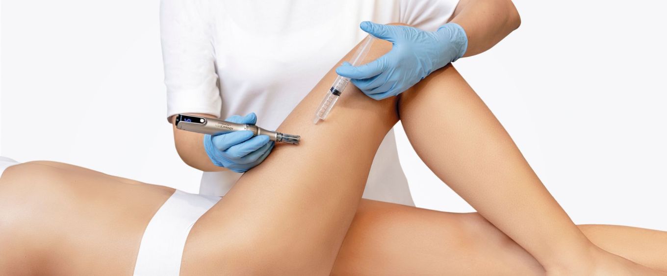 SkinExpert Advance corporal, microneedling